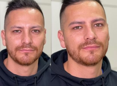Microblading para hombres en Barcelona